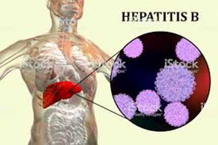 Hepatitis C, B - Dr. Vida Orsolya